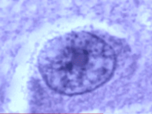 naegleria fowleri
