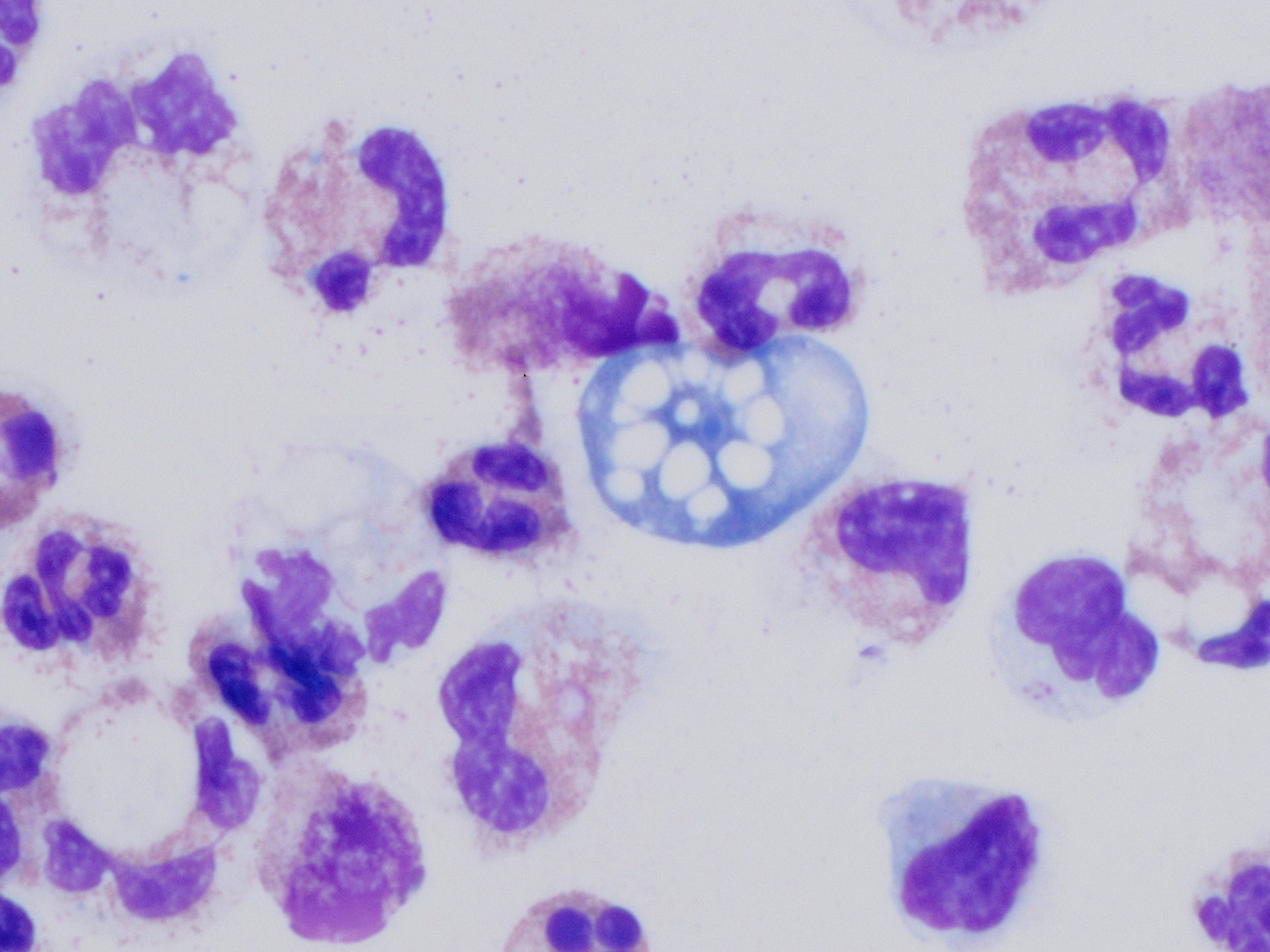 naegleria fowleri under a microscope