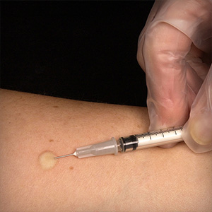 TB Test TB Test